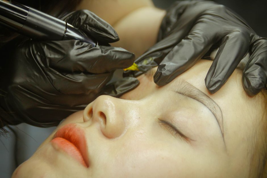 eliminación tatuaje láser